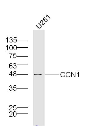 U251 lysates probed with Cry61 Polyclonal Antibody, Unconjugated (bs-1290R) at 1:300 overnight at 4˚C. Followed by a conjugated secondary antibody at 1:5000 for 90 min at 37˚C.
