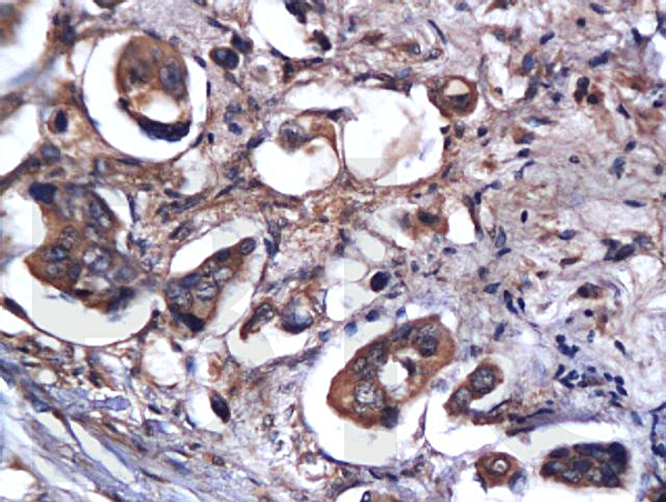 Formalin-fixed and paraffin embedded rat brain labeled with Anti-Caspase-9 Polyclonal Antibody, Unconjugated(bs-0049R) 1:200 followed by conjugation to the secondary antibody and DAB staining