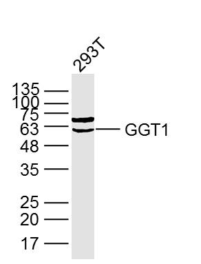 Lane 1: 293T lysates probed with GGT1 Polyclonal Antibody, Unconjugated (bs-2976R) at 1:300 overnight at 4˚C. Followed by a conjugated secondary antibody at 1:5000 for 90 min at 37˚C.
