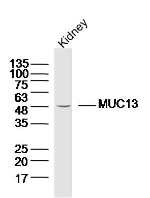 Lane 1: Mouse kidney lysates probed with Anti MUC13 Polyclonal Antibody, Unconjugated (bs-10074R) at 1:300 overnight at 4˚C. Followed by a conjugated secondary antibody at 1:5000 for 90 min at 37˚C.