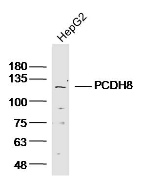 Lane 1: HepG2 lysates probed with Anti PCDH8 Polyclonal Antibody, Unconjugated (bs-11114R) at 1:300 overnight at 4˚C. Followed by a conjugated secondary antibody at 1:5000 for 90 min at 37˚C.