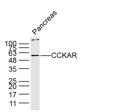 Lane 1: Mouse pancreas lysates probed with Anti CCKAR Polyclonal Antibody, Unconjugated (bs-11514R) at 1:300 overnight at 4˚C. Followed by a conjugated secondary antibody at 1:5000 for 90 min at 37˚C.