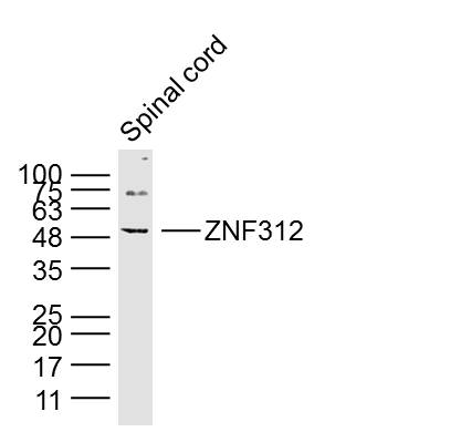 Lane 1: Mouse spinal cord lysates probed with Anti –ZNF312 Polyclonal Antibody, Unconjugated (bs-12148R) at 1:300 overnight at 4˚C. Followed by a conjugated secondary antibody at 1:5000 for 90 min at 37˚C.