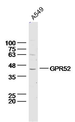 Lane 1: A549 lysates probed with Anti –GPR52 Polyclonal Antibody, Unconjugated (bs-13539R) at 1:300 overnight at 4˚C. Followed by a conjugated secondary antibody at 1:5000 for 90 min at 37˚C.