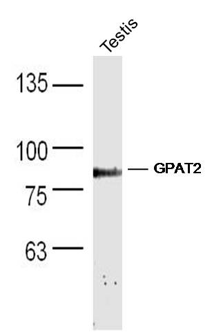 Lane 1: Mouse testis lysates probed with Anti –GPAT2 Polyclonal Antibody, Unconjugated (bs-13497R) at 1:300 overnight at 4˚C. Followed by a conjugated secondary antibody at 1:5000 for 90 min at 37˚C.