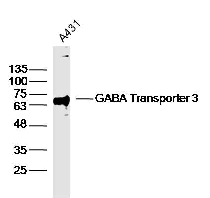 Lane 1: A431 lysates probed with Anti –GABA Transporter 3/GAT 3 Polyclonal Antibody, Unconjugated (bs-13260R) at 1:300 overnight at 4˚C. Followed by a conjugated secondary antibody at 1:5000 for 90 min at 37˚C.