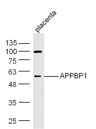 Lane 1: Mouse placenta lysates probed with Anti –APPBP1 Polyclonal Antibody, Unconjugated (bs-12503R) at 1:300 overnight at 4˚C. Followed by a conjugated secondary antibody at 1:5000 for 90 min at 37˚C.