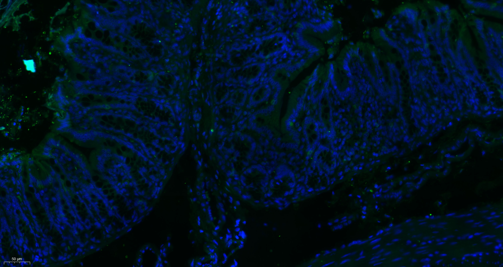 Paraformaldehyde-fixed, paraffin embedded Rat colon; Antigen retrieval by boiling in sodium citrate buffer (pH6.0) for 15min; Block endogenous peroxidase by 3% hydrogen peroxide for 20 minutes; Blocking buffer (normal goat serum) at 37°C for 30min; Antibody incubation with MTM1 Polyclonal Antibody, Unconjugated (bs-9178R) at 1:400 overnight at 4°C, followed by a conjugated secondary antibody for 90 minutes, and DAPI for nuclei staining.