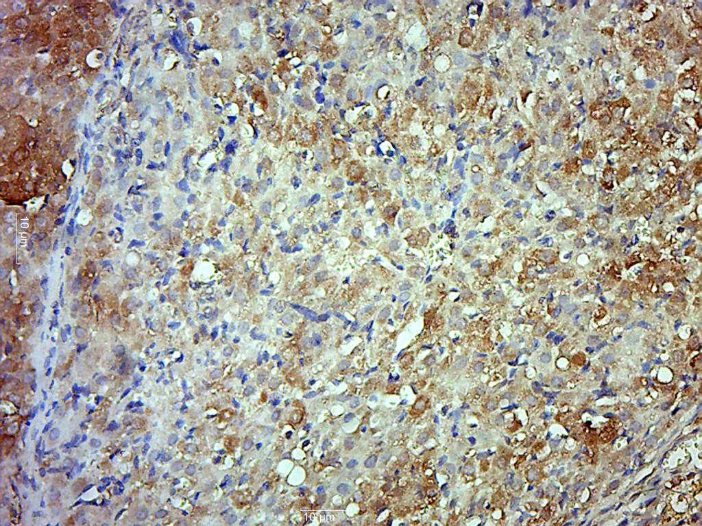 Paraformaldehyde-fixed, paraffin embedded Rat ovary; Antigen retrieval by boiling in sodium citrate buffer (pH6.0) for 15min; Block endogenous peroxidase by 3% hydrogen peroxide for 20 minutes; Blocking buffer (normal goat serum) at 37°C for 30min; Antibody incubation with Fibulin 5 Polyclonal Antibody, Unconjugated (bs-0810R) at 1:500 overnight at 4°C, followed by a conjugated secondary for 20 minutes and DAB staining.