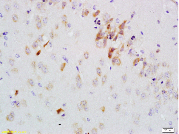 Formalin-fixed and paraffin embedded rat brain labeled with Anti-GDNF-Receptor-alpha-2 Polyclonal Antibody, Unconjugated(bs-0054R) 1:200 followed by conjugation to the secondary antibody and DAB staining