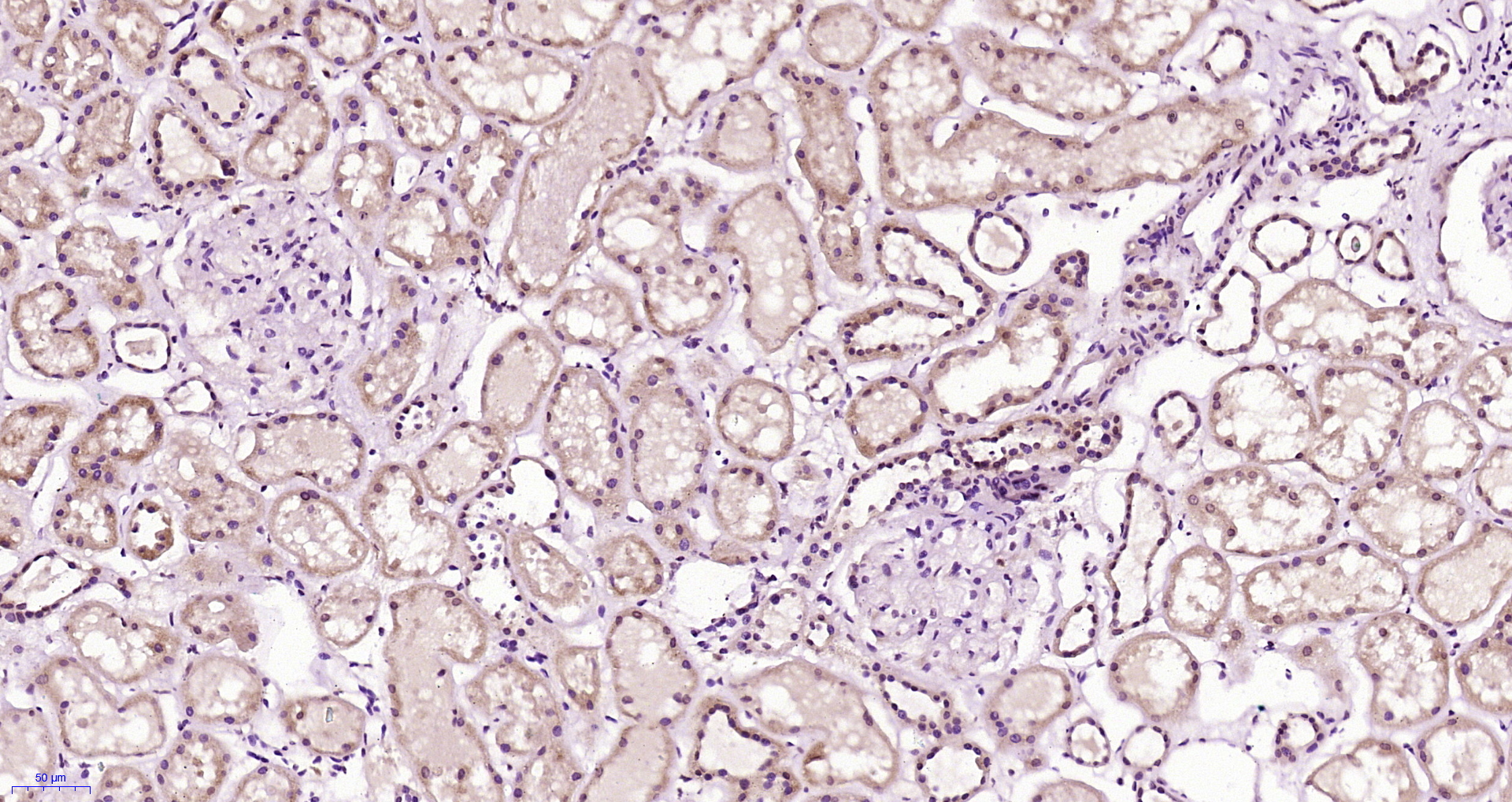 Paraformaldehyde-fixed, paraffin embedded Human kidney; Antigen retrieval by boiling in sodium citrate buffer (pH6.0) for 15min; Block endogenous peroxidase by 3% hydrogen peroxide for 20 minutes; Blocking buffer (normal goat serum) at 37°C for 30min; Antibody incubation with CLEC9A Polyclonal Antibody, Unconjugated (bs-13620R) at 1:400 overnight at 4°C, followed by a conjugated secondary antibody for 20 minutes and DAB staining.