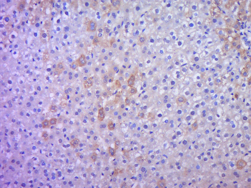 Paraformaldehyde-fixed, paraffin embedded rat liver; Antigen retrieval by boiling in sodium citrate buffer (pH6.0) for 15min; Block endogenous peroxidase by 3% hydrogen peroxide for 20 minutes; Blocking buffer (normal goat serum) at 37°C for 30min; Antibody incubation with IHH Polyclonal Antibody, Unconjugated (bs-6624R) at 1:500 overnight at 4°C, followed by a conjugated secondary for 20 minutes and DAB staining.