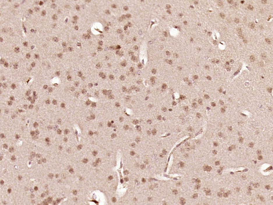 Paraformaldehyde-fixed, paraffin embedded mouse brain; Antigen retrieval by boiling in sodium citrate buffer (pH6.0) for 15min; Block endogenous peroxidase by 3% hydrogen peroxide for 20 minutes; Blocking buffer (normal goat serum) at 37°C for 30min; Antibody incubation with LHX2 Polyclonal Antibody, Unconjugated (bs-11200R) at 1:500 overnight at 4°C, followed by a conjugated secondary for 20 minutes and DAB staining.