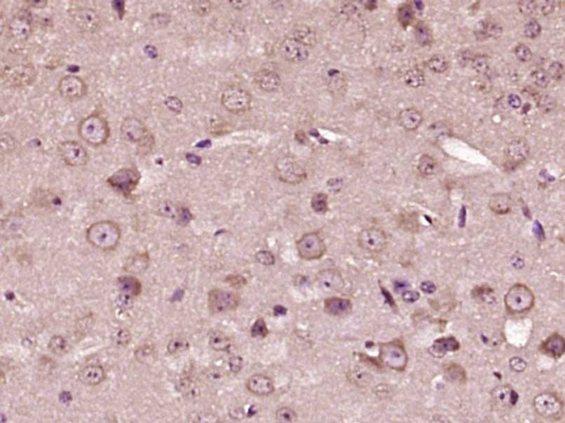 Paraformaldehyde-fixed, paraffin embedded mouse brain; Antigen retrieval by boiling in sodium citrate buffer (pH6) for 15min; Block endogenous peroxidase by 3% hydrogen peroxide for 30 minutes;  Blocking buffer (normal goat serum) at 37\u00b0C for 20min; Antibody incubation with CRF Polyclonal Antibody, Unconjugated (bs-0382R) at 1:400 overnight at 4\u00b0C, followed by a conjugated secondary and DAB staining.