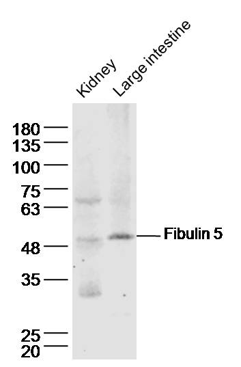 Lane 1: Mouse kidney lysates; Lane 2: Mouse large intestine lysates; probed with Fibulin 5 Polyclonal Antibody, unconjugated (bs-0810R) at 1:300 overnight at 4\u00b0C followed by a conjugated secondary antibody for 60 minutes at 37\u00b0C.