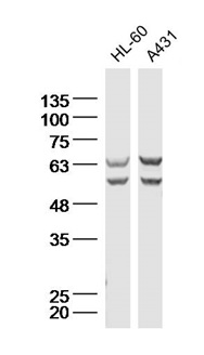 Lane 1: HL-60 Cell lysates; Lane 2: A431 Cell lysates; probed with Natriuretic Peptide Receptor C Polyclonal Antibody, unconjugated (bs-2333R) at 1:300 overnight at 4°C followed by a conjugated secondary antibody for 60 minutes at 37°C.