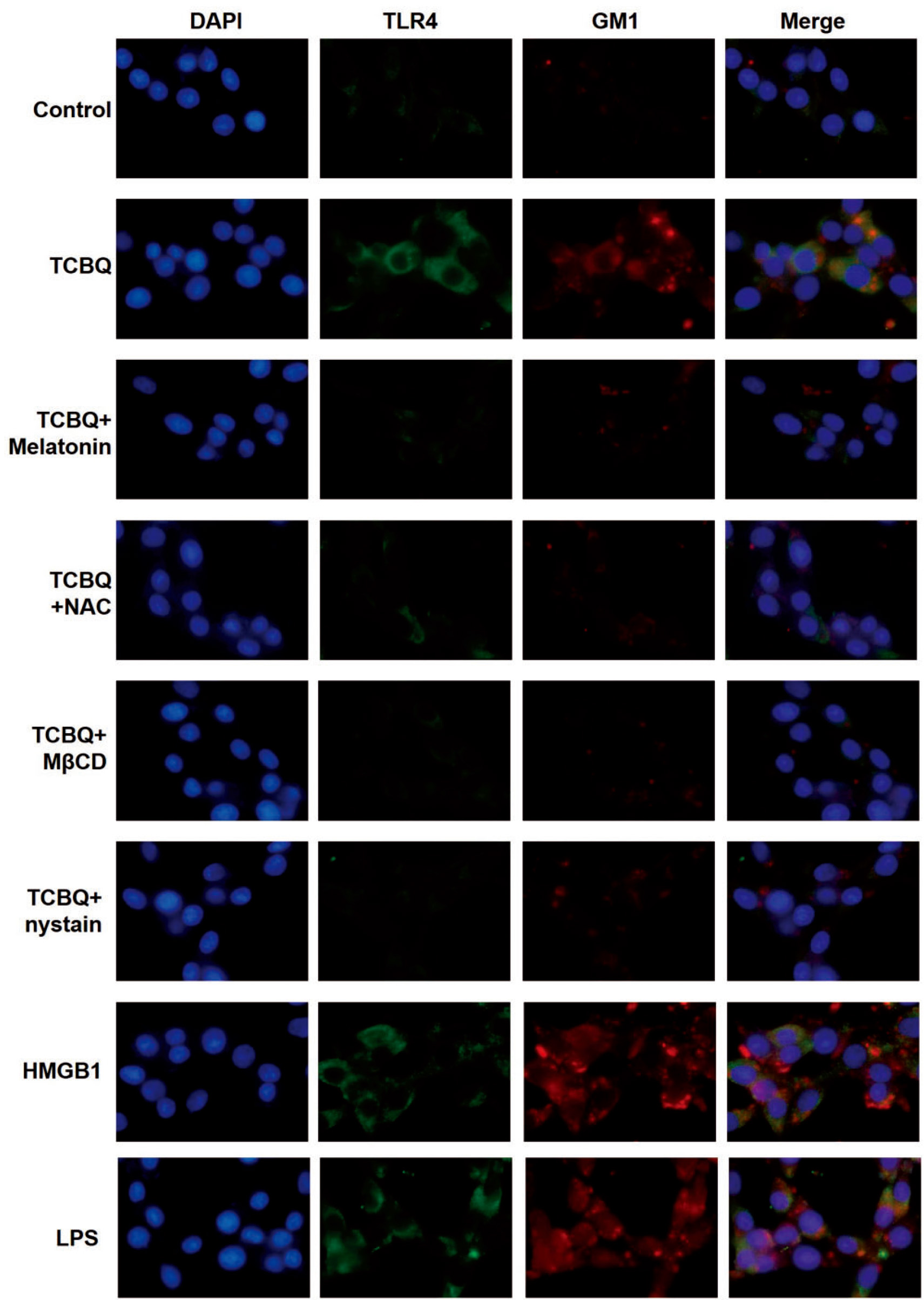 This image was generously provided by Juanli Fu, at Southwest University in Chong Qing, China. 4% Paraformaldehyde fixed PC12 cells stained with Rabbit Anti- TLR4 Polyclonal Antibody (bs-20594R) at 1:300 for 3 hours at 4°C, followed by Alexa Fluor 488-conjugated secondary antibody for an additional hour.