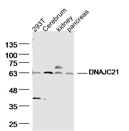 Lane 1: HT29 Cell lysates; Lane 2: mouse Cerebrum Cell lysates; Lane 3: Mouse kidney lysates; Lane 4: Mouse pancreas lysates; probed with DNAJC21 Polyclonal Antibody, unconjugated (bs-14387R) at 1:300 overnight at 4°C followed by a conjugated secondary antibody for 60 minutes at 37°C.