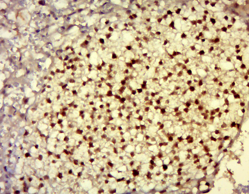 Paraformaldehyde-fixed, paraffin embedded mouse placenta tissue; Antigen retrieval by boiling in sodium citrate buffer (pH6.0) for 15min; Block endogenous peroxidase by 3% hydrogen peroxide for 20 minutes; Blocking buffer (normal goat serum) at 37°C for 30min; Antibody incubation with DNAJC21 Polyclonal Antibody, Unconjugated (bs-14387R) at 1:400 overnight at 4°C, followed by a conjugated secondary antibody for 20 minutes and DAB staining.