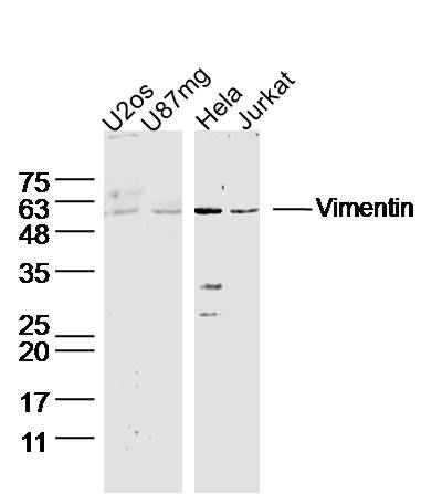 Lane 1: U2OS Cell lysates; Lane 2: U87MG Cell lysates; Lane 3: HeLa lysates; Lane 4: Jurkat lysates; probed with Vimentin Polyclonal Antibody, unconjugated (bs-23063R) at 1:300 overnight at 4\u00b0C followed by a conjugated secondary antibody for 60 minutes at 37\u00b0C.
