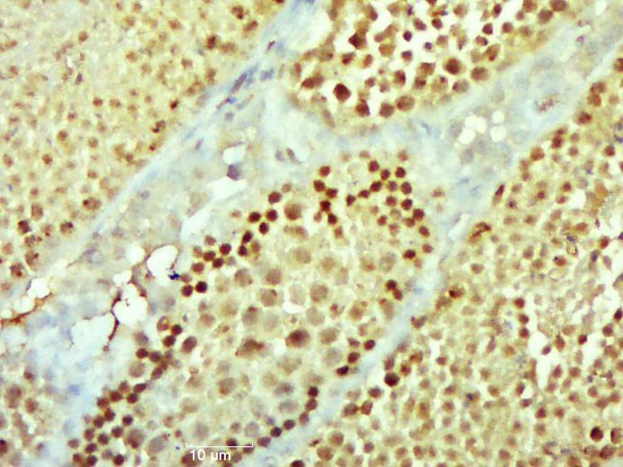 Paraformaldehyde-fixed, paraffin embedded mouse testis; Antigen retrieval by boiling in sodium citrate buffer (pH6.0) for 15min; Block endogenous peroxidase by 3% hydrogen peroxide for 20 minutes; Blocking buffer (normal goat serum) at 37°C for 30min; Antibody incubation with _x000D_ NEK11 Polyclonal Antibody, Unconjugated (bs-19195R) at 1:400 overnight at 4°C, followed by a conjugated secondary antibody for 20 minutes and DAB staining.