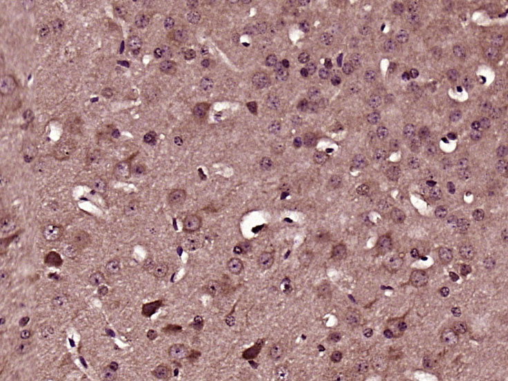 Paraformaldehyde-fixed, paraffin embedded mouse brain; Antigen retrieval by boiling in sodium citrate buffer (pH6) for 15min; Block endogenous peroxidase by 3% hydrogen peroxide for 30 minutes; Blocking buffer (normal goat serum) at 37°C for 20min; Antibody incubation with ADAM23 Polyclonal Antibody, Unconjugated (bs-5853R) at 1:200 overnight at 4°C, followed by a conjugated secondary and DAB staining.
