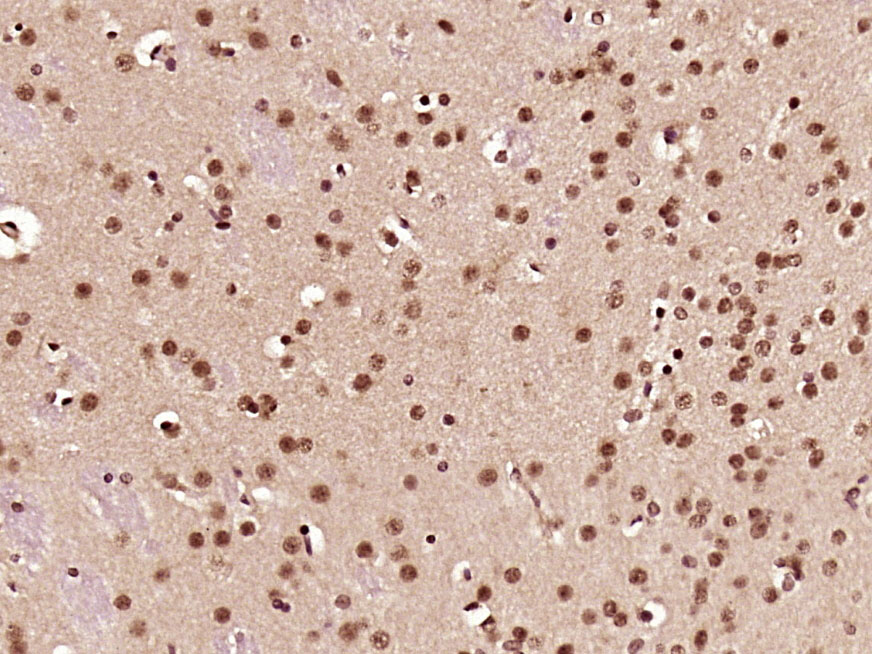 Paraformaldehyde-fixed, paraffin embedded rat brain; Antigen retrieval by boiling in sodium citrate buffer (pH6) for 15min; Block endogenous peroxidase by 3% hydrogen peroxide for 30 minutes; Blocking buffer (normal goat serum) at 37°C for 20min; Antibody incubation with CCDC42 Polyclonal Antibody, Unconjugated (bs-8131R) at 1:200 overnight at 4°C, followed by a conjugated secondary and DAB staining.