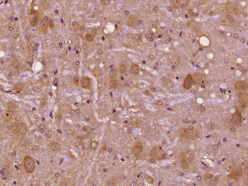 Paraformaldehyde-fixed, paraffin embedded Rat Brain; Antigen retrieval by boiling in sodium citrate buffer (pH6) for 15min; Block endogenous peroxidase by 3% hydrogen peroxide for 30 minutes; Blocking buffer (normal goat serum) at 37°C for 20min; Antibody incubation with CASK/CAMGUK Polyclonal Antibody, Unconjugated (bs-11338R) at 1:200 overnight at 4°C, followed by a conjugated secondary and DAB staining.