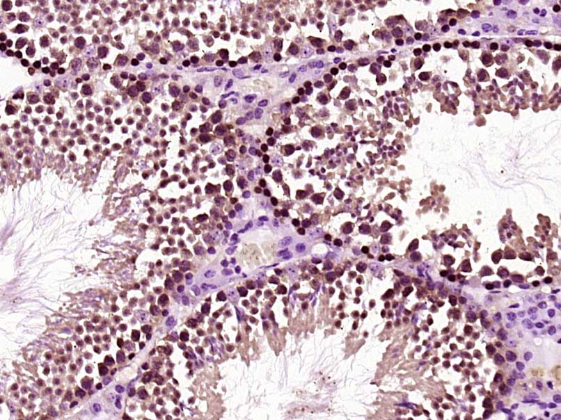 Paraformaldehyde-fixed, paraffin embedded Mouse testis; Antigen retrieval by boiling in sodium citrate buffer (pH6) for 15min; Block endogenous peroxidase by 3% hydrogen peroxide for 30 minutes; Blocking buffer (normal goat serum) at 37°C for 20min; Antibody incubation with HOXC5 Polyclonal Antibody, Unconjugated (bs-11589R) at 1:200 overnight at 4°C, followed by a conjugated secondary and DAB staining.