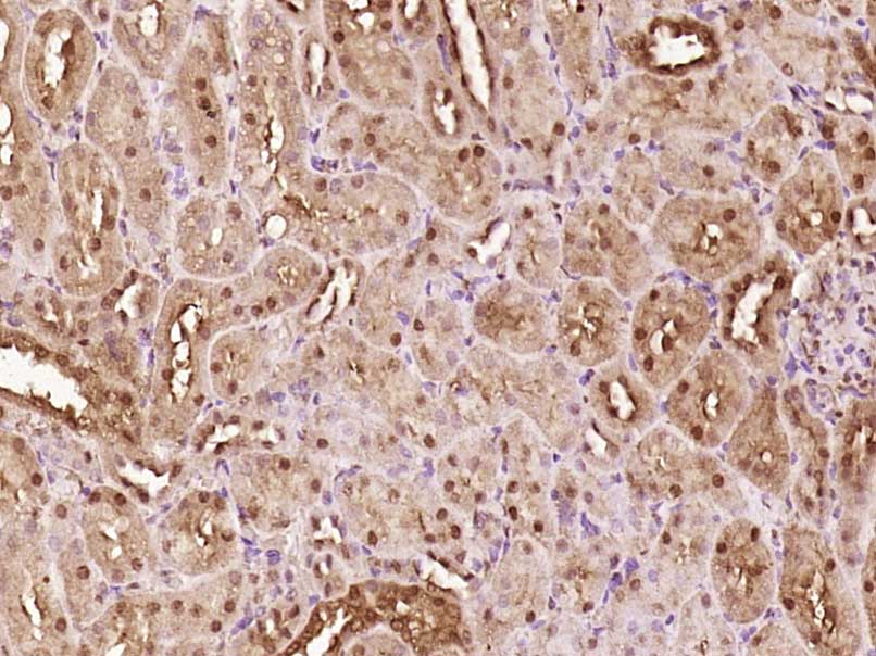 Paraformaldehyde-fixed, paraffin embedded rat kidney; Antigen retrieval by boiling in sodium citrate buffer (pH6) for 15min; Block endogenous peroxidase by 3% hydrogen peroxide for 30 minutes; Blocking buffer (normal goat serum) at 37°C for 20min; Antibody incubation with ATBF1 Polyclonal Antibody, Unconjugated (bs-11805R) at 1:200 overnight at 4°C, followed by a conjugated secondary and DAB staining.