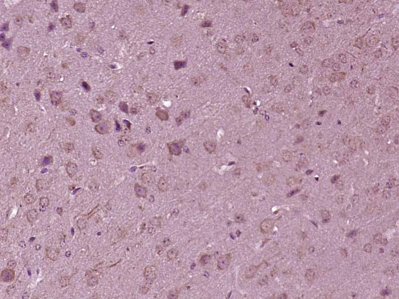 Paraformaldehyde-fixed, paraffin embedded mouse brain; Antigen retrieval by boiling in sodium citrate buffer (pH6) for 15min; Block endogenous peroxidase by 3% hydrogen peroxide for 30 minutes; Blocking buffer (normal goat serum) at 37°C for 20min; Antibody incubation with KIF7 Polyclonal Antibody, Unconjugated (bs-12388R)at 1:200 overnight at 4°C, followed by a conjugated secondary and DAB staining.