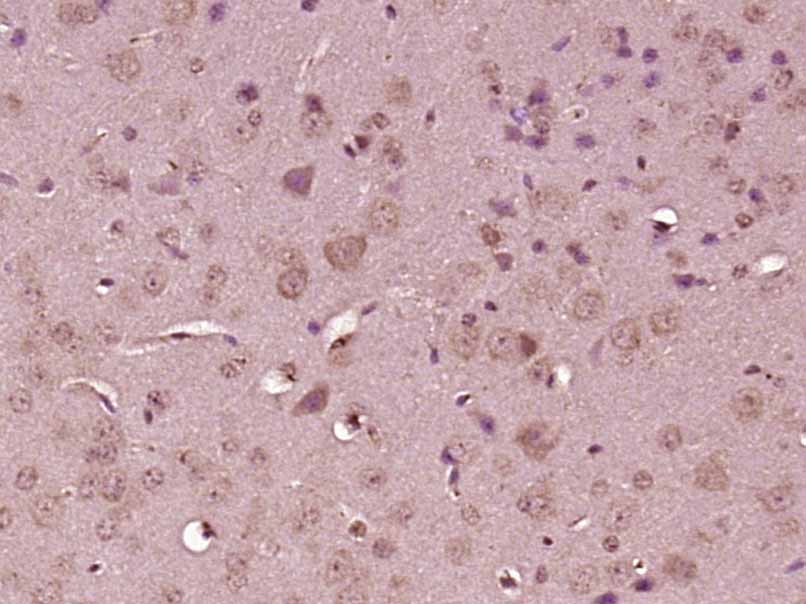 Paraformaldehyde-fixed, paraffin embedded mouse brain; Antigen retrieval by boiling in sodium citrate buffer (pH6) for 15min; Block endogenous peroxidase by 3% hydrogen peroxide for 30 minutes; Blocking buffer (normal goat serum) at 37°C for 20min; Antibody incubation with MAPK6/ERK3 Polyclonal Antibody, Unconjugated (bs-12405R)at 1:200 overnight at 4°C, followed by a conjugated secondary and DAB staining.