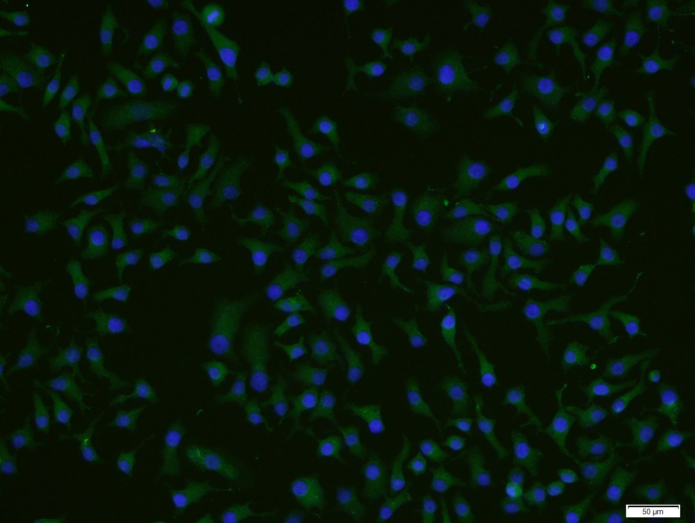 HepG2 cells were stained with ADCK4 Polyclonal Antibody, Unconjugated (bs-8070R) at 1:200 and incubated for 90 minutesat room temperature, followed by secondary antibody incubation, DAPI staining of the nuclei and detection.