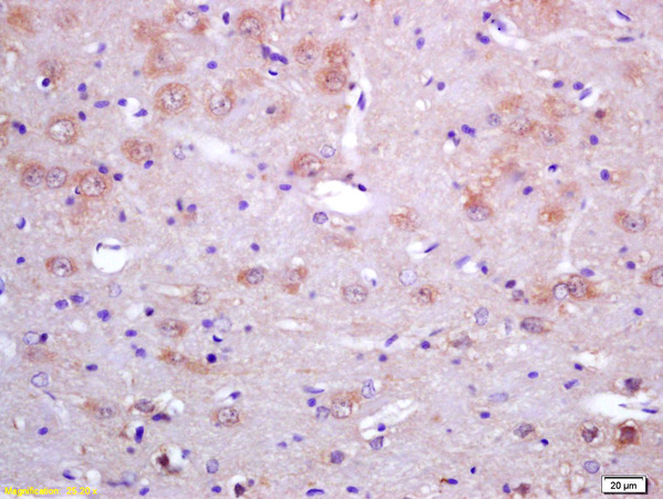 Formalin-fixed and paraffin embedded rat brain tissue labeled with RABBIT ANTI-SAHH POLYCLONAL ANTIBODY, Unconjugated (bs-5029R) at 1:200 followed by conjugation to the secondary antibody and DAB staining.\n
