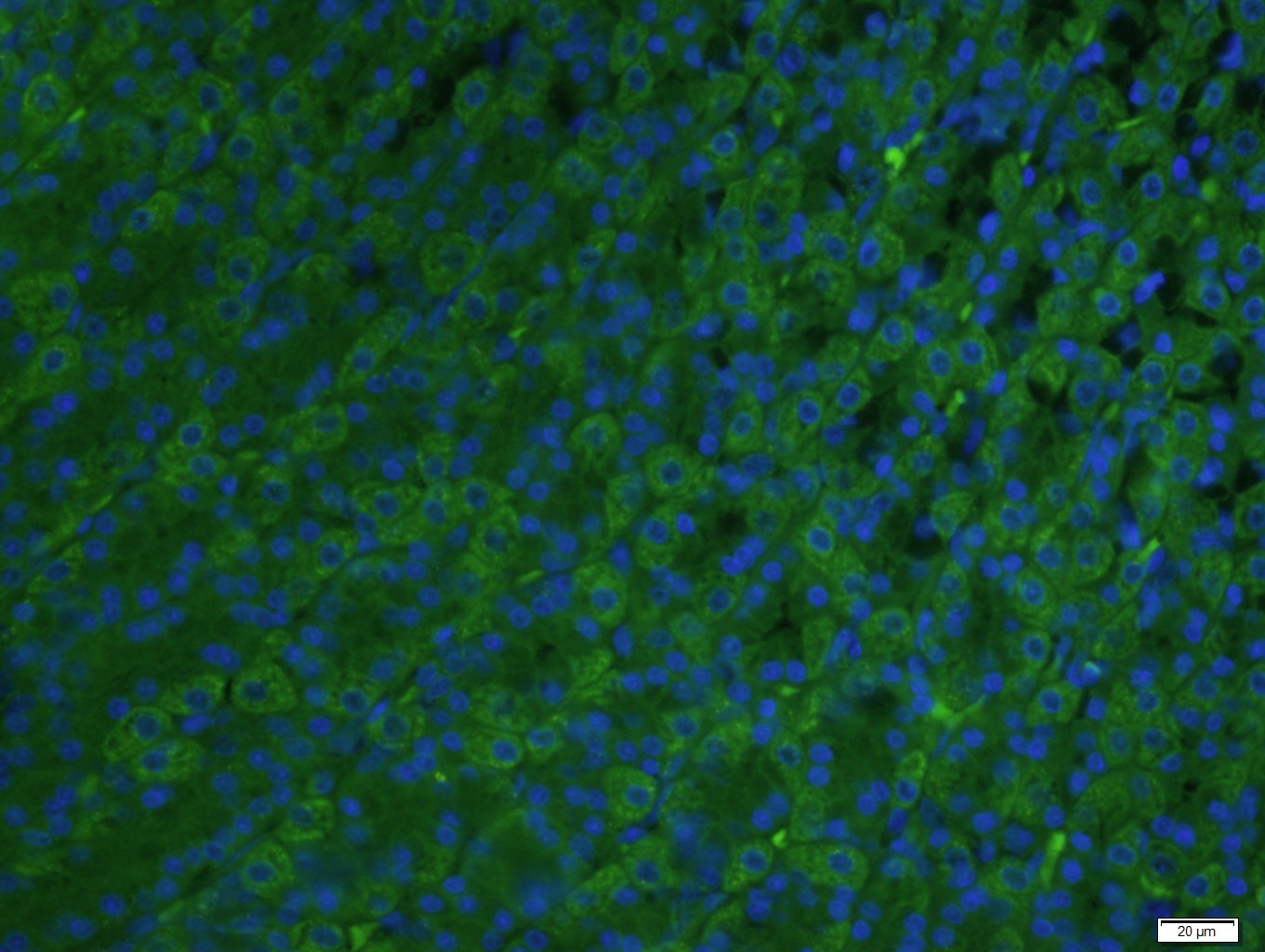 Paraformaldehyde-fixed, paraffin embedded rat stomach; Antigen retrieval by boiling in sodium citrate buffer (pH6.0) for 15min; Block endogenous peroxidase by 3% hydrogen peroxide for 20 minutes; Blocking buffer (normal goat serum) at 37°C for 30min; Antibody incubation with ADCK4 Polyclonal Antibody, Unconjugated (bs-8070R) at 1:400 overnight at 4°C, followed by a conjugated Goat Anti-Rabbit IgG antibody (bs-0295G-FITC) for 90 minutes, and DAPI for nuclei staining.