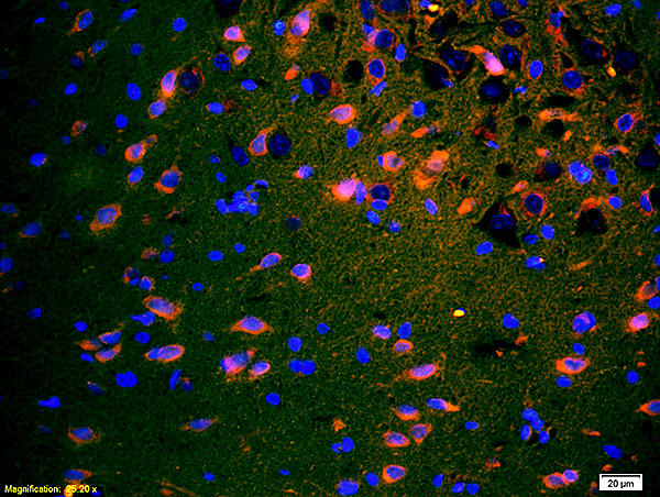 Formalin-fixed and paraffin embedded rat brain labeled with Anti-SPR Polyclonal Antibody, Unconjugated (bs-0064R) 1:200 followed by conjugation to the secondary antibody and DAB staining