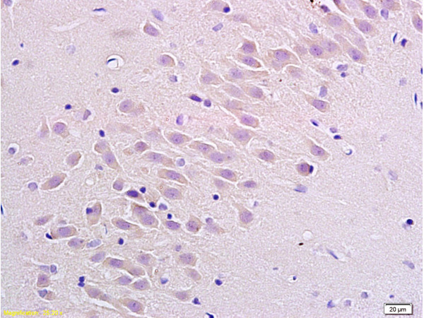 Formalin-fixed and paraffin embedded rat brain labeled with Anti Substance P Receptor\/NK1R Polyclonal Antibody, Unconjugated (bs-0064R) at 1:200 followed by conjugation to the secondary antibody Goat Anti-Rabbit IgG, PE conjugated (bs-0295G-PE)used at 1:200 dilution for 40 minutes at 37\u00b0C.