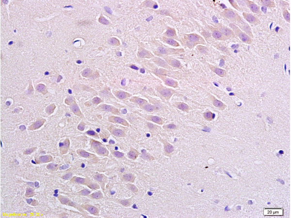 Formalin-fixed and paraffin embedded rat brain labeled with Anti Substance P Receptor/NK1R Polyclonal Antibody, Unconjugated (bs-0064R) at 1:200 followed by conjugation to the secondary antibody Goat Anti-Rabbit IgG, PE conjugated (bs-0295G-PE)used at 1:200 dilution for 40 minutes at 37°C.
