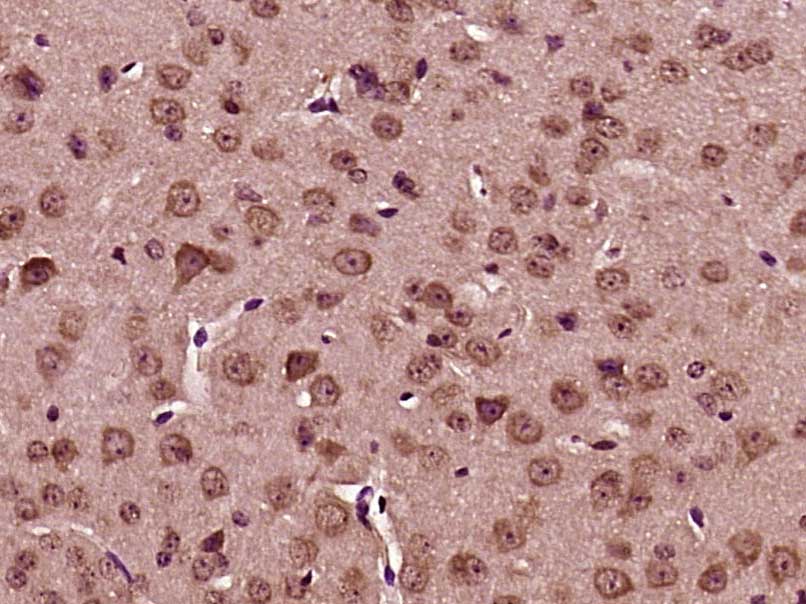 Paraformaldehyde-fixed, paraffin embedded mouse brain; Antigen retrieval by boiling in sodium citrate buffer (pH6) for 15min; Block endogenous peroxidase by 3% hydrogen peroxide for 30 minutes; Blocking buffer (normal goat serum) at 37°C for 20min; Antibody incubation with BRAF35 Polyclonal Antibody, Unconjugated (bs-12883R) at 1:200 overnight at 4°C, followed by a conjugated secondary and DAB staining.