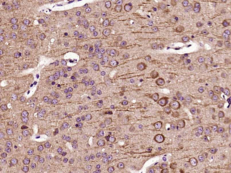 Paraformaldehyde-fixed, paraffin embedded mouse brain; Antigen retrieval by boiling in sodium citrate buffer (pH6) for 15min; Block endogenous peroxidase by 3% hydrogen peroxide for 30 minutes;  Blocking buffer (normal goat serum) at 37\u00b0C for 20min; Antibody incubation with Leptin receptor Polyclonal Antibody, Unconjugated (bs-0961R) at 1:200 overnight at 4\u00b0C, followed by a conjugated secondary and DAB staining.