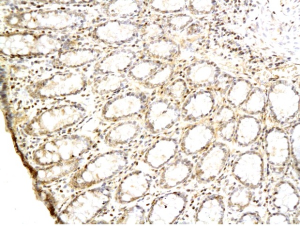 Formalin-fixed and paraffin embedded rat colon labeled with Anti-TGF alpha Polyclonal Antibody Unconjugated (bs-0066R) followed by conjugation to the secondary antibody and DAB staining