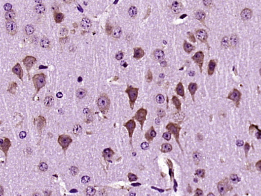 Paraformaldehyde-fixed, paraffin embedded Mouse brain; Antigen retrieval by boiling in sodium citrate buffer (pH6.0) for 15min; Block endogenous peroxidase by 3% hydrogen peroxide for 20 minutes; Blocking buffer (normal goat serum) at 37°C for 30min; Antibody incubation with Dscam Polyclonal Antibody, Unconjugated (bs-11456R) at 1:400 overnight at 4°C, followed by operating according to and DAB staining.