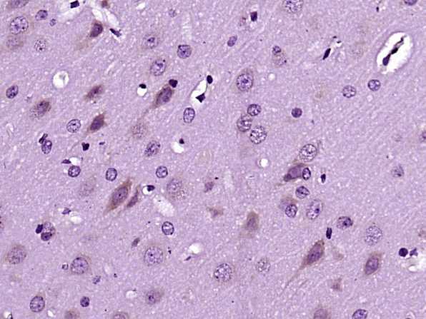 Paraformaldehyde-fixed, paraffin embedded Rat brain; Antigen retrieval by boiling in sodium citrate buffer (pH6.0) for 15min; Block endogenous peroxidase by 3% hydrogen peroxide for 20 minutes; Blocking buffer (normal goat serum) at 37°C for 30min; Antibody incubation with Dscam Polyclonal Antibody, Unconjugated (bs-11456R) at 1:400 overnight at 4°C, followed by operating according to DAB staining.
