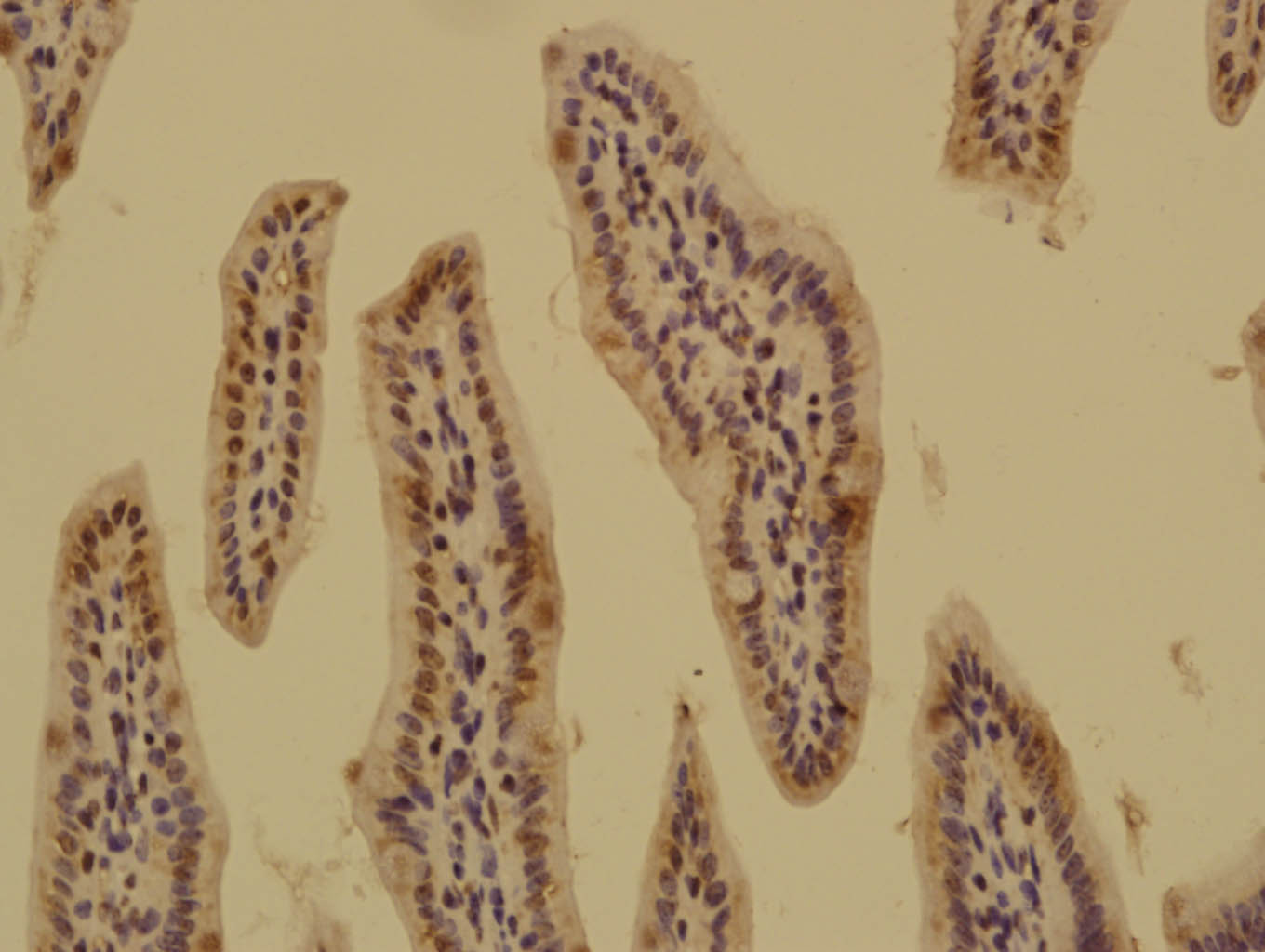 Paraformaldehyde-fixed, paraffin embedded Mouse small intestine; Antigen retrieval by boiling in sodium citrate buffer (pH6.0) for 15min; Block endogenous peroxidase by 3% hydrogen peroxide for 20 minutes; Blocking buffer (normal goat serum) at 37°C for 30min; Antibody incubation with ASAP1 Polyclonal Antibody, Unconjugated (bs-4091R) at 1:500 overnight at 4°C, followed by a conjugated secondary for 20 minutes and DAB staining.