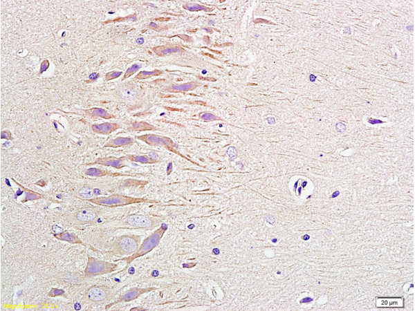 Formalin-fixed and paraffin embedded rat brain labeled with Anti-NPY\/Neuropeptide Y Polyclonal Antibody, Unconjugated(bs-0071R) 1:400 followed by conjugation to the secondary antibody and DAB staining