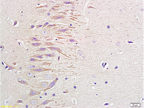 Formalin-fixed and paraffin embedded rat brain labeled with Anti-NPY/Neuropeptide Y Polyclonal Antibody, Unconjugated(bs-0071R) 1:400 followed by conjugation to the secondary antibody and DAB staining