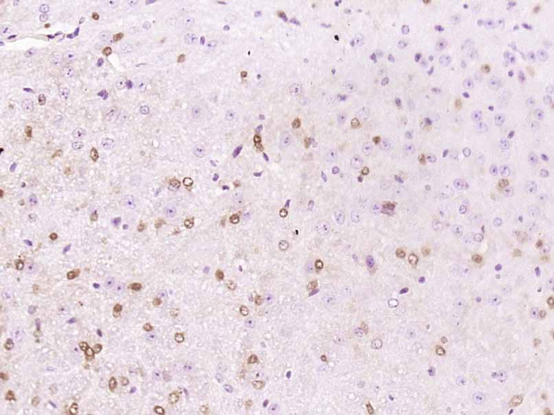 Paraformaldehyde-fixed, paraffin embedded mouse brain; Antigen retrieval by boiling in sodium citrate buffer (pH6) for 15min; Block endogenous peroxidase by 3% hydrogen peroxide for 30 minutes; Blocking buffer (normal goat serum) at 37°C for 20min; Antibody incubation with APBA1 Polyclonal Antibody, Unconjugated (bs-11334R)at 1:200 overnight at 4°C, followed by a conjugated secondary and DAB staining.