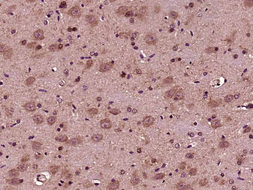 Paraformaldehyde-fixed, paraffin embedded rat brain; Antigen retrieval by boiling in sodium citrate buffer (pH6) for 15min; Block endogenous peroxidase by 3% hydrogen peroxide for 30 minutes;  Blocking buffer (normal goat serum) at 37\u00b0C for 20min; Antibody incubation with Aggrecan Polyclonal Antibody, Unconjugated (bs-11655R)at 1:200 overnight at 4\u00b0C, followed by a conjugated secondary and DAB staining.