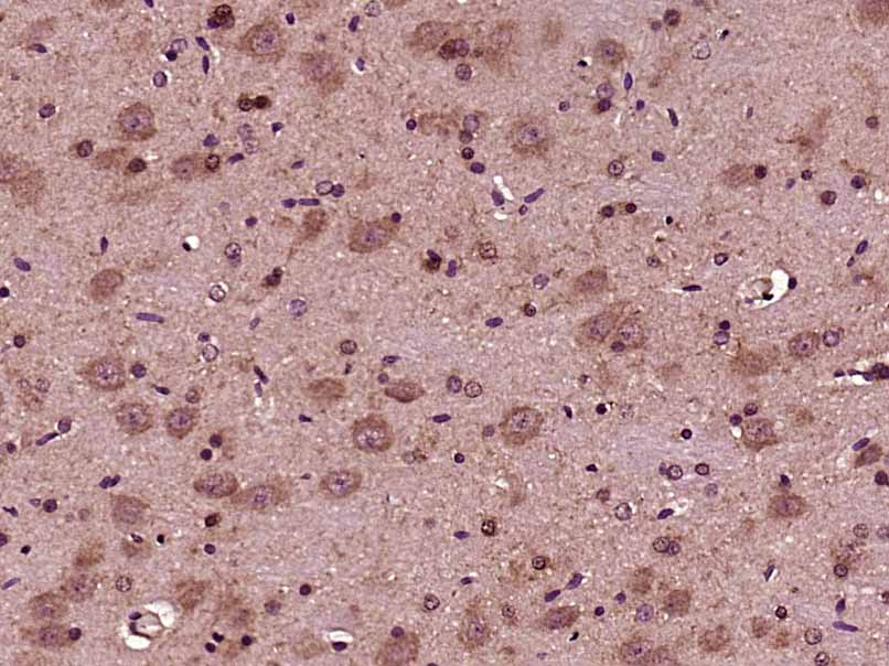 Paraformaldehyde-fixed, paraffin embedded rat brain; Antigen retrieval by boiling in sodium citrate buffer (pH6) for 15min; Block endogenous peroxidase by 3% hydrogen peroxide for 30 minutes; Blocking buffer (normal goat serum) at 37°C for 20min; Antibody incubation with Aggrecan Polyclonal Antibody, Unconjugated (bs-11655R)at 1:200 overnight at 4°C, followed by a conjugated secondary and DAB staining.