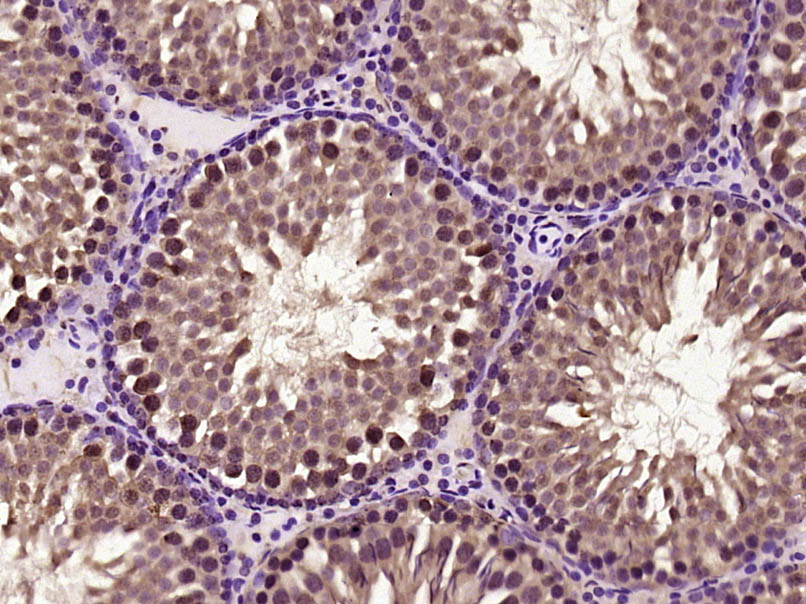 Paraformaldehyde-fixed, paraffin embedded rat testis; Antigen retrieval by boiling in sodium citrate buffer (pH6) for 15min; Block endogenous peroxidase by 3% hydrogen peroxide for 30 minutes; Blocking buffer (normal goat serum) at 37°C for 20min; Antibody incubation with C1orf200 Polyclonal Antibody, Unconjugated (bs-15055R) at 1:400 overnight at 4°C, followed by a conjugated secondary and DAB staining.